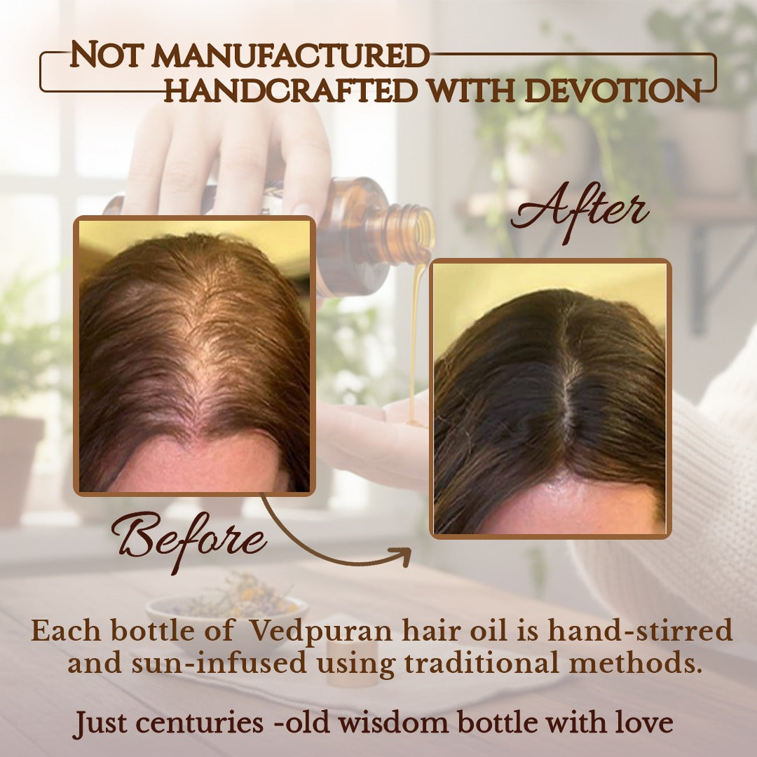 Jattamni Hair Oil – Ayurvedic Oil for Hair Fall & Growth